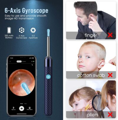 Ear Wax Removal - Image 3